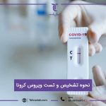 شرایط و تشخیص ویروس کرونا در آزمایشگاه تهران لب