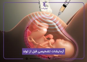 آزمایشات تشخیصی قبل از تولد