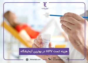 هزینه تست HPV در بهترین آزمایشگاه