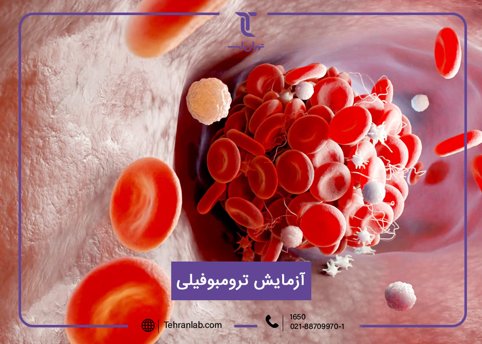 آزمایش ترومبوفیلی
