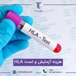 هزینه آزمایش و تست HLA