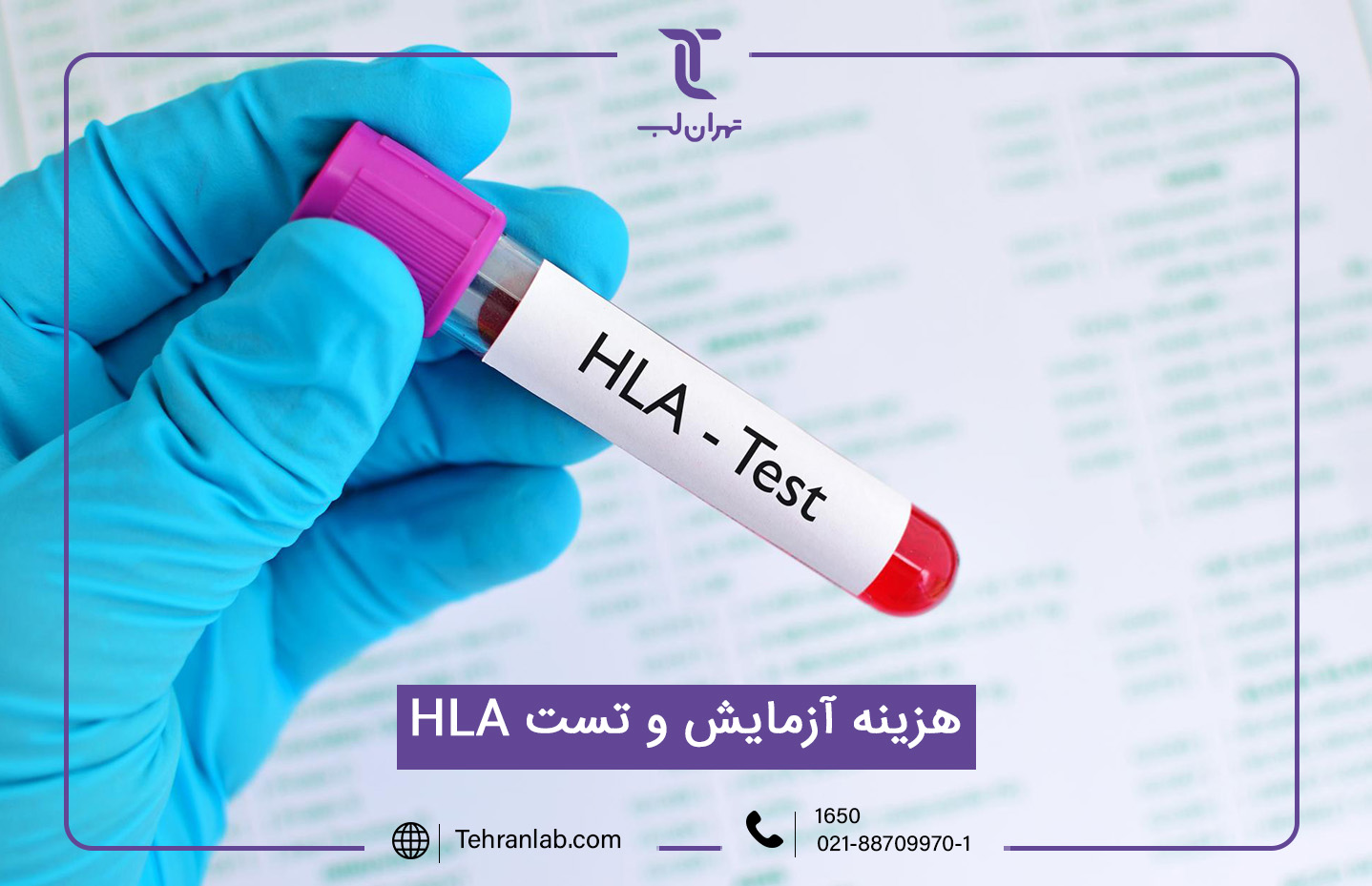 هزینه آزمایش و تست HLA