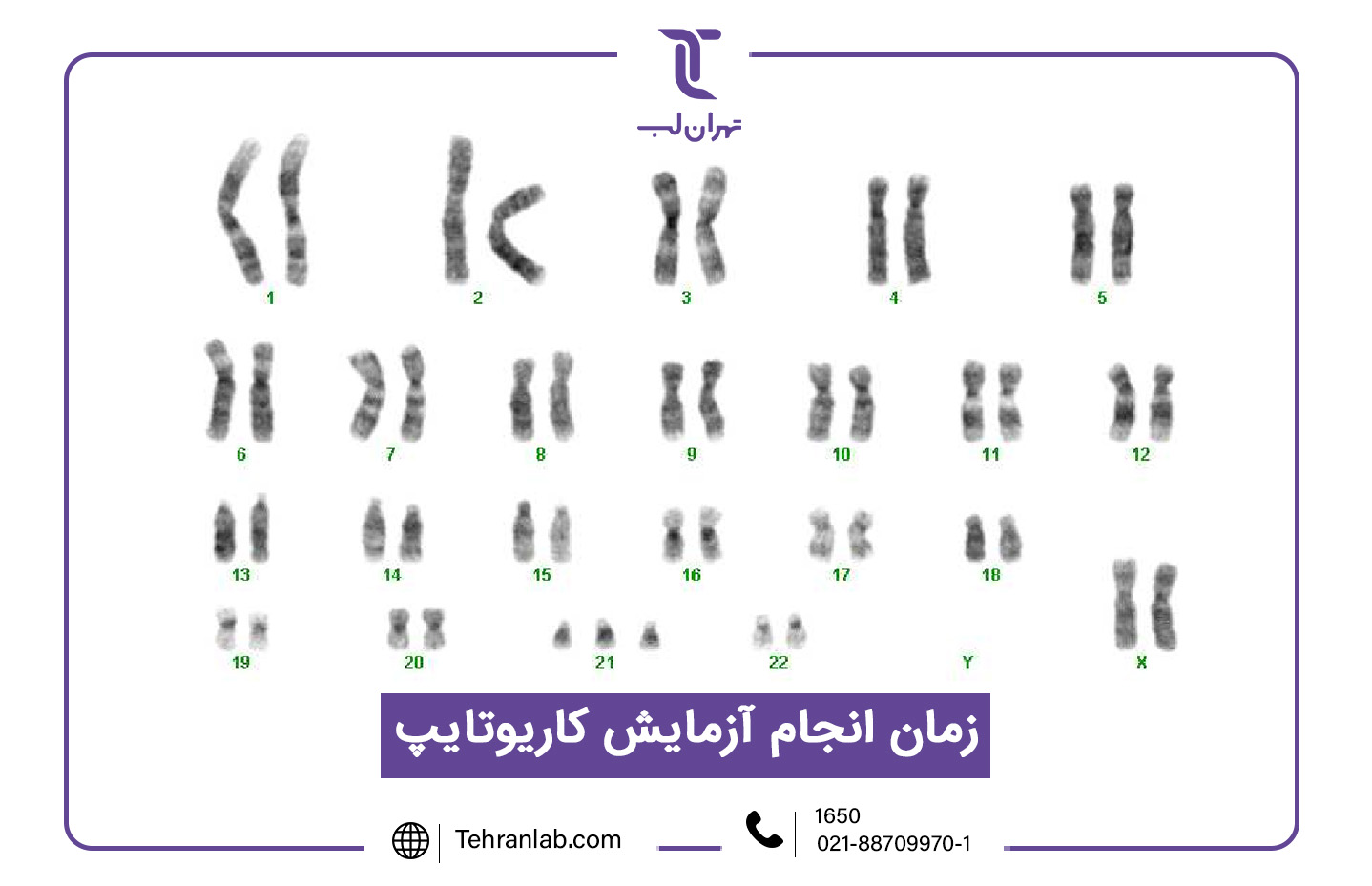 زمان انجام آزمایش کاریوتایپ