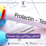آزمایش پرولاکتین برای چیست؟ + قیمت و شرایط انجام آزمایش پرولاکتین