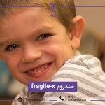 سندروم Fragile-X