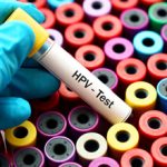آزمایش HPV