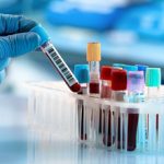 آزمایش غربالگری