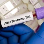 آزمایش سل فری