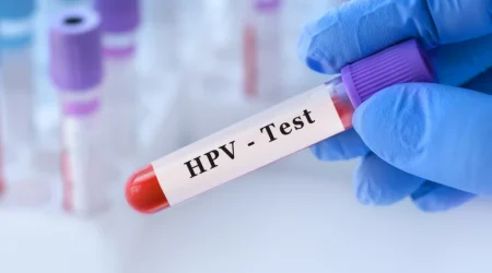 HPV-Screening-1024x1024
